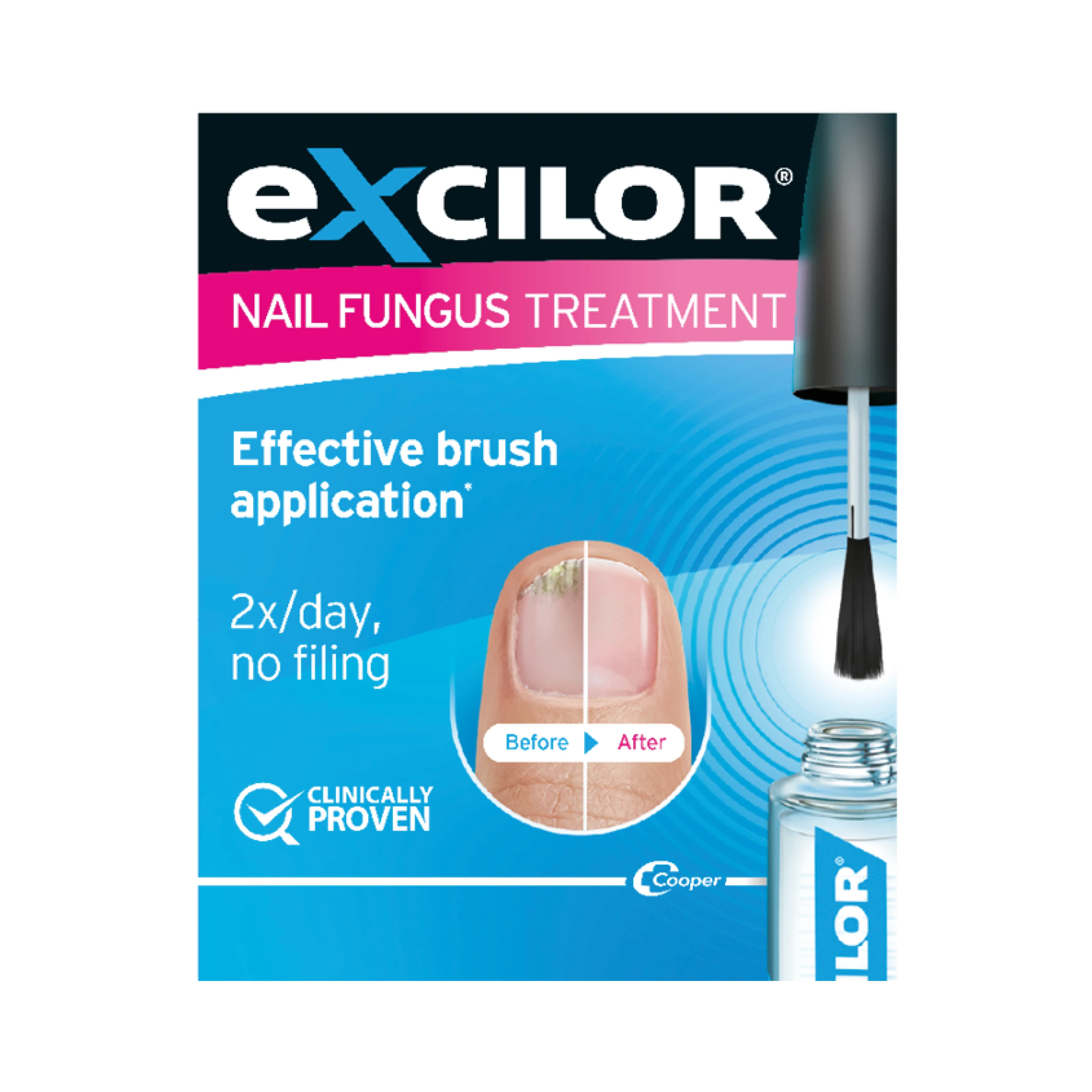 Excilor Solution - 3.3ml